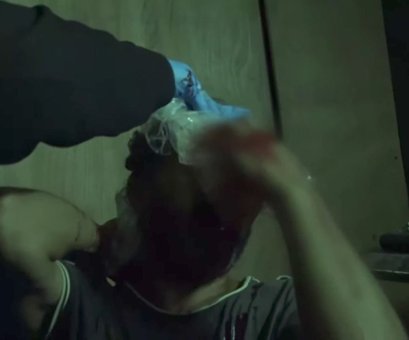 Survivor Bayhan kanlar içinde kaldı, apar topar hastaneye kaldırıldı! Acun Ilıcalı kötü haberi duyurdu - Resim: 3