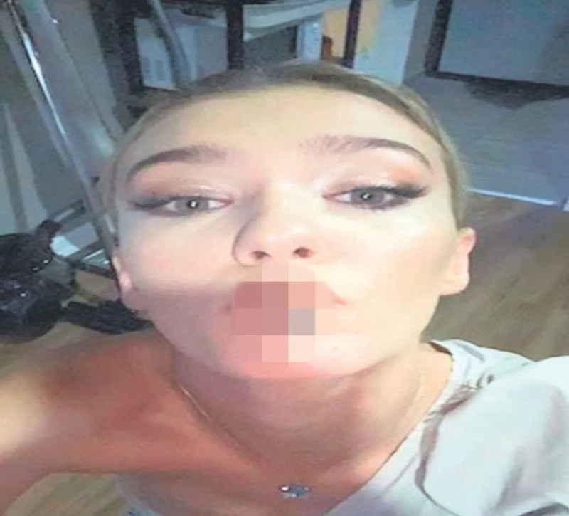 Melisa Döngel'in uyuşturucu yazışmaları! Madde kullandığı fotoğrafı ortaya çıktı: "Acil kanka, kokcu var mı?" - Resim: 2