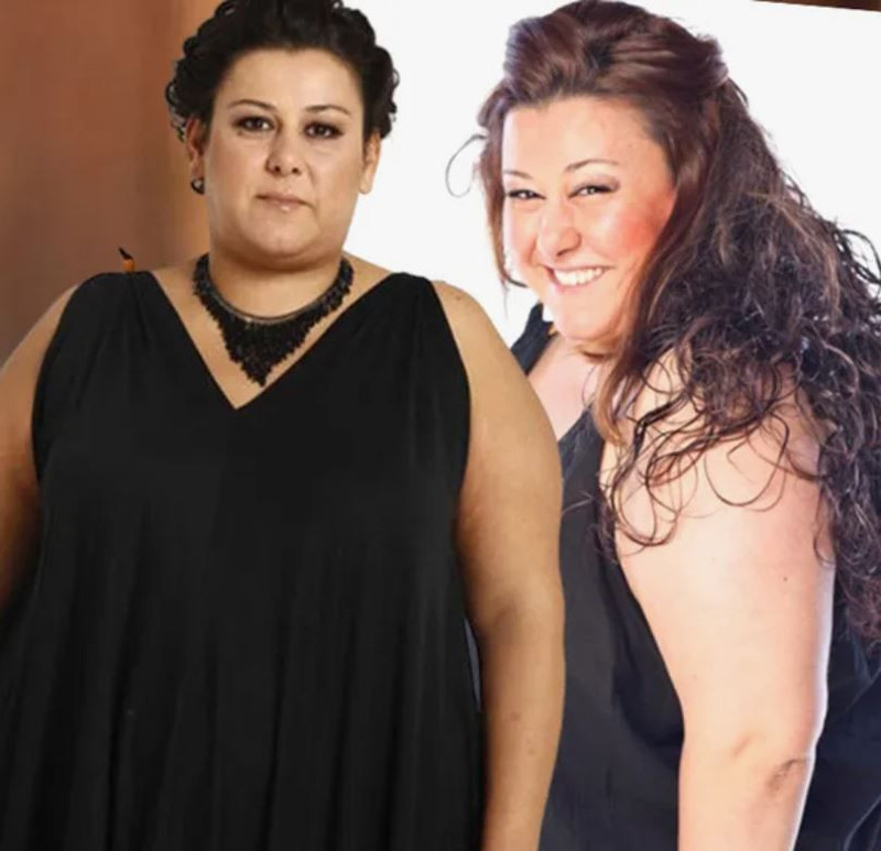 72 kilo veren oyuncu Esin Gündoğdu son haliyle şok etti! İğne ipliğe döndü - Resim: 4