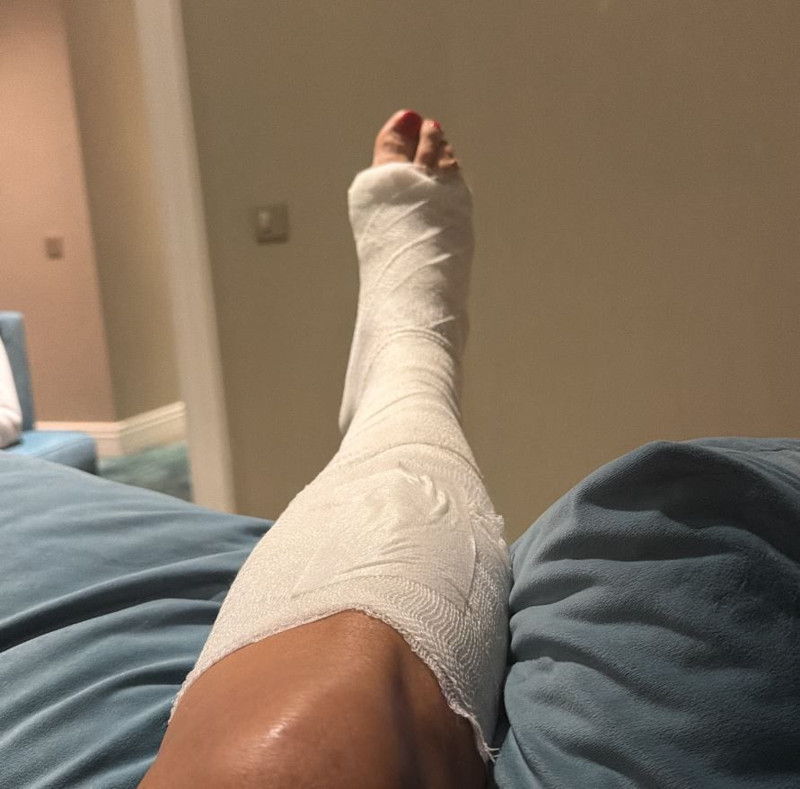 Ünlü şarkıcı Işın Karaca'dan korkutan haber! Kaza geçirdi - Resim: 4