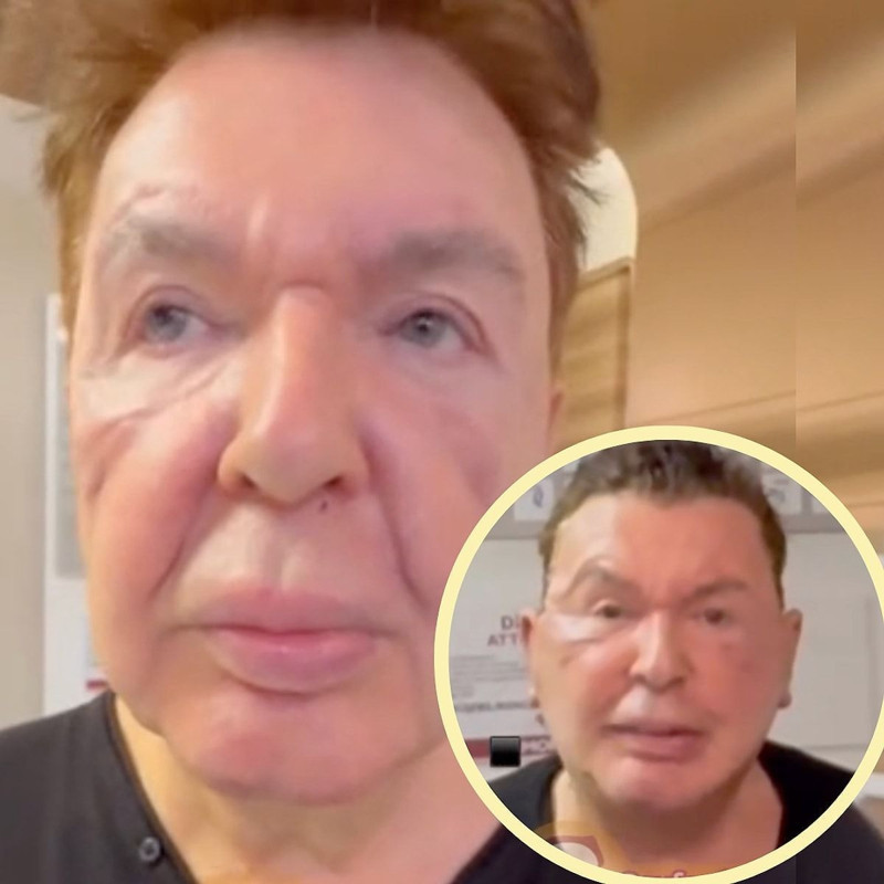 Yüz gerdirme operasyonu geçirmişti! Kuşum Aydın son halini paylaştı - Resim: 5