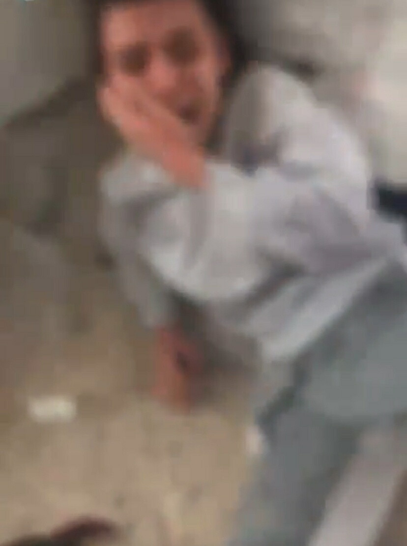 Vicdansızlığın bu kadarı! Kız kardeşini darp etti yetmedi kaynar su döküp özür diletti - Resim : 1