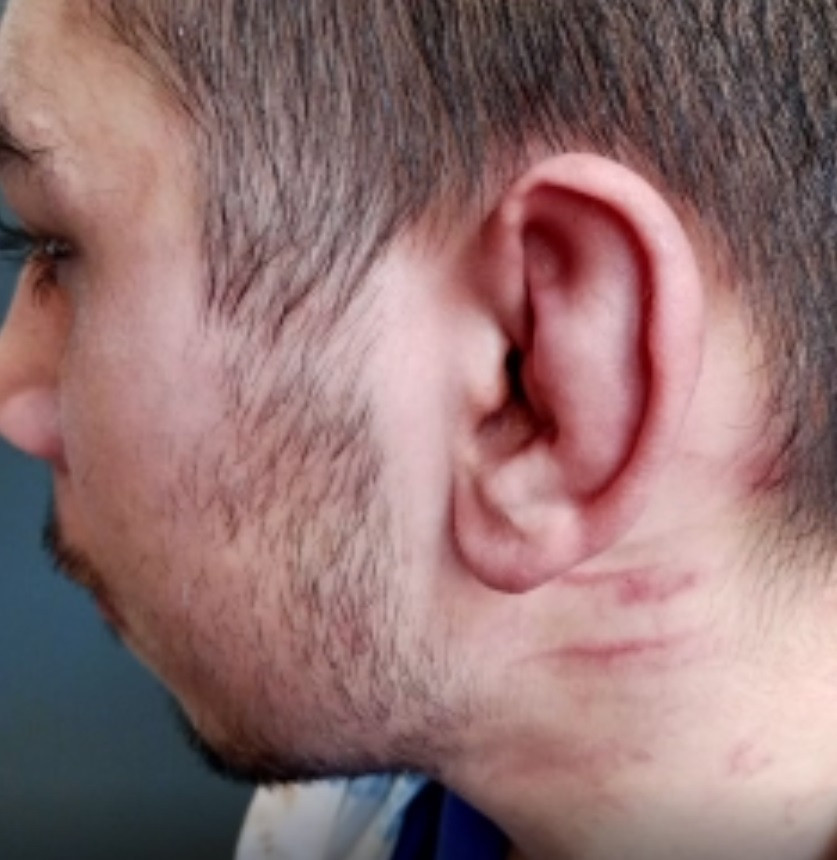 Özel bakımevindeki işkencede iddianame hazırlandı! Epilepsi hastası Uğur fazla verilen ilaçla öldürmüştü... İşte hemşire için istenen ceza - Resim : 1