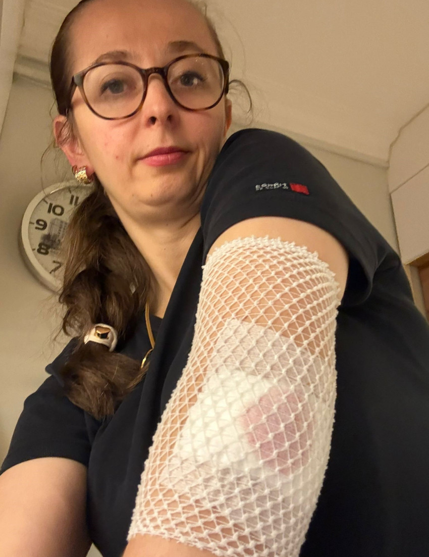 Okul çıkışında dehşet! Ters yönden gelen scooter, kadına ve çocuğa çarptı; o anlar kamerada - Resim : 3