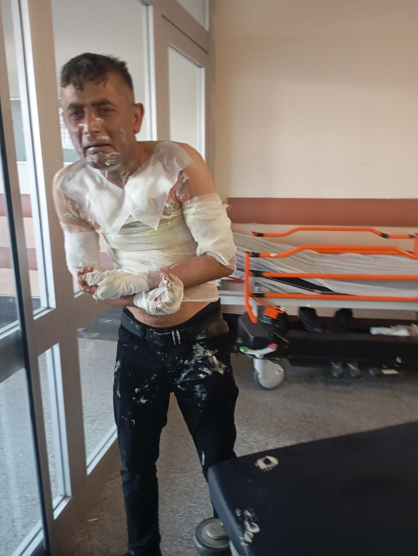 İstanbul'da kan donduran vahşet! Engelli adamı gasp edip, benzinle yaktı - Resim : 4