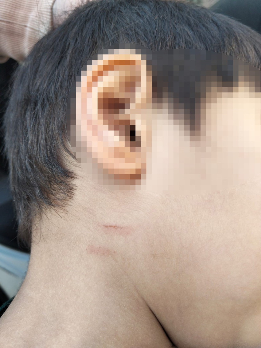 Bu görüntüler izleyenlerin yüreğini yaktı! Otizmli çocuğa eğitim merkezinde şiddet: Benim çocuğum mahvoldu - Resim : 1