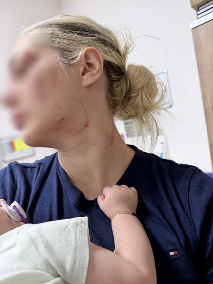 Eşinden gördüğü şiddeti kayda almıştı! Bakanlık harekete geçti: Şiddete sıfır tolerans - Resim : 1