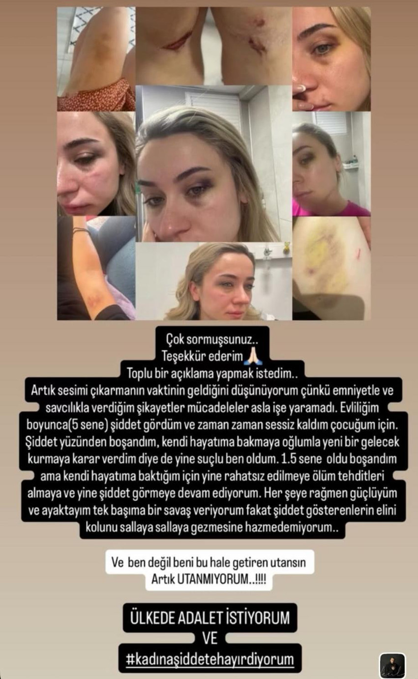 Elif öğretmen 'Beni yıllarca dövdü' dedi, ortalık karıştı! Stadyumda tekme tokat dövdüler - Resim : 2