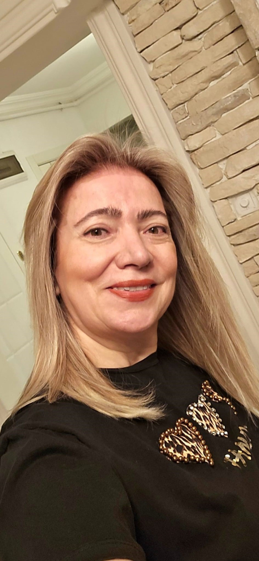 Ankara&rsquo;da botoks faciası! G&uuml;zellik uğruna fel&ccedil; oldu: Ağzım yamuldu, y&uuml;z&uuml;m &ouml;ld&uuml; - Resim : 4