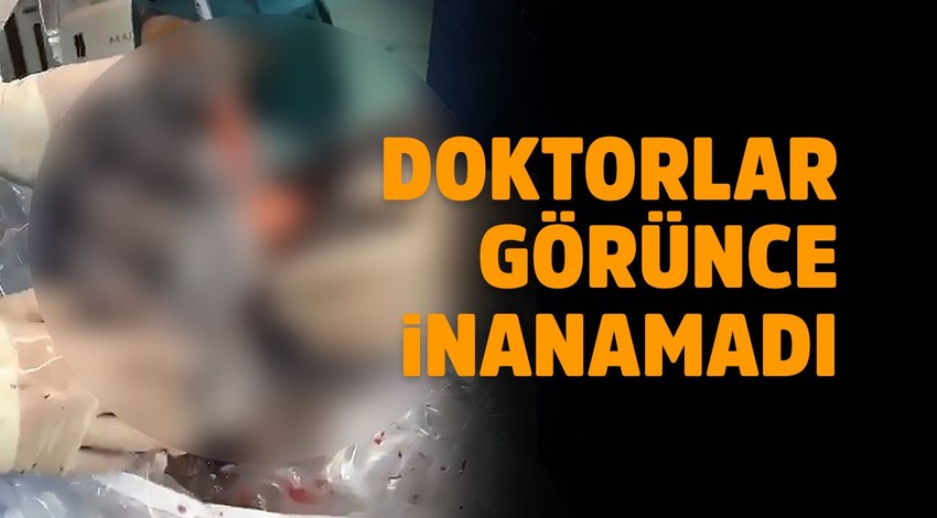 Doktorları bile şoke etti