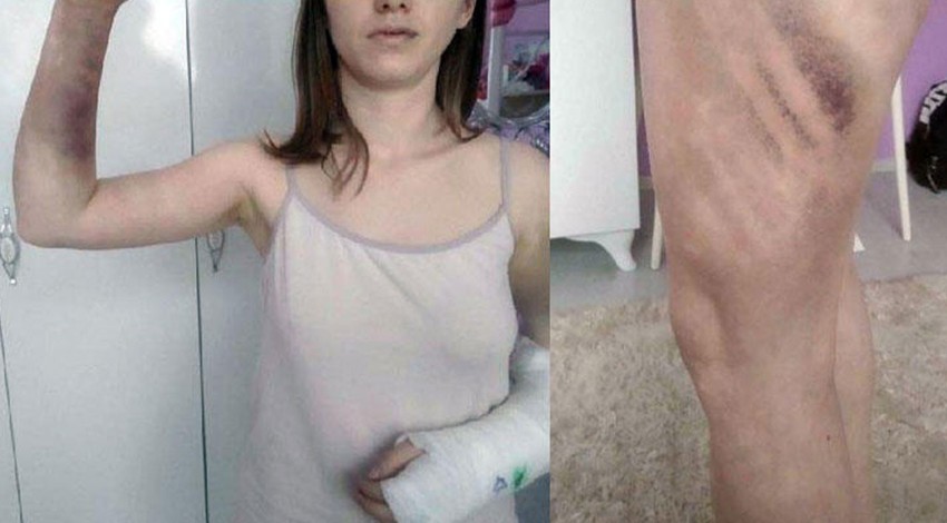 Beyzbol sopasıyla 18 saat boyunca dövdü! İşte istenen ceza