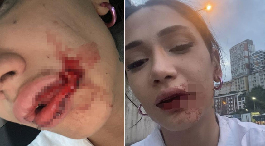 Önce taciz etti, tepki görünce 2 kız kardeşi öldüresiye dövdü!