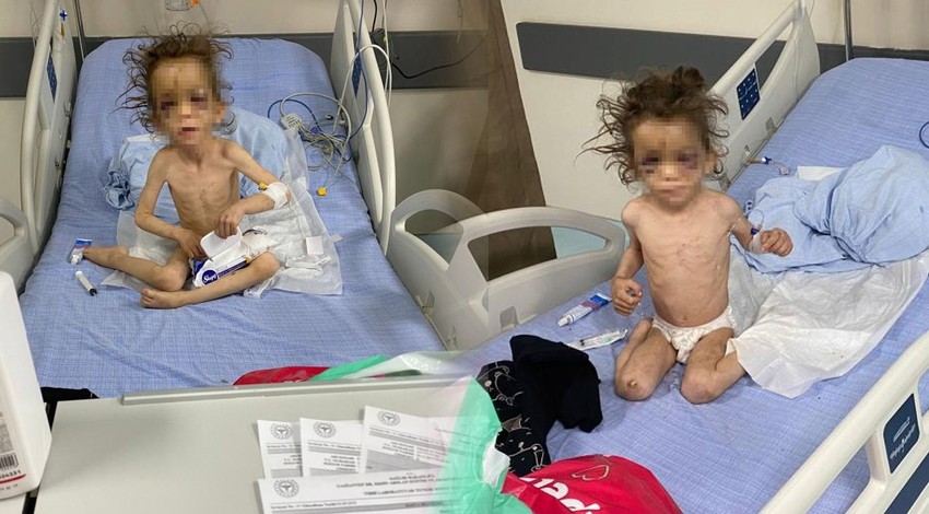 Bu nasıl anne! 5 yaşındaki çocuk günlerce işkenceye maruz kaldı! Baba çocuğunu tanıyamadı