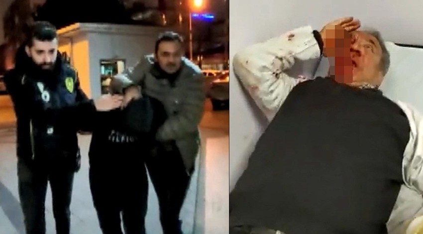 Doktora dehşeti yaşatan saldırganın ifadesi ortaya çıktı: Tuvalet ihtiyacımı gidermek için...