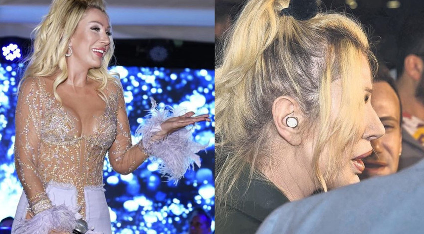 İşitme cihazı dikkat çekmişti! Seda Sayan'ın kulağına ne oldu?