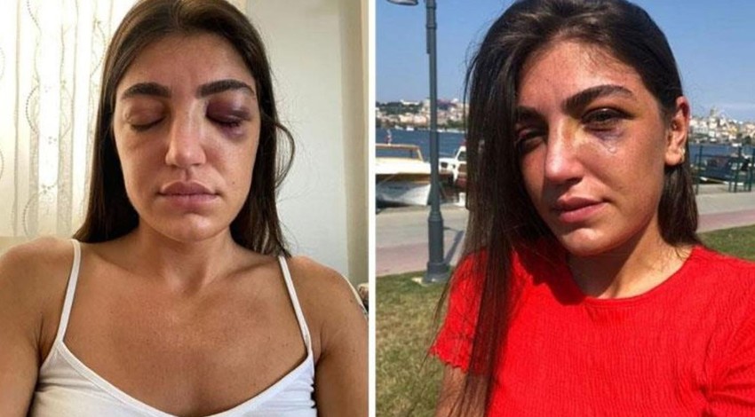 Eğlenmeye giden manken dehşeti yaşamıştı! Serbest bırakıldığı için tepki çeken eski sevgilinin cezası belli oldu