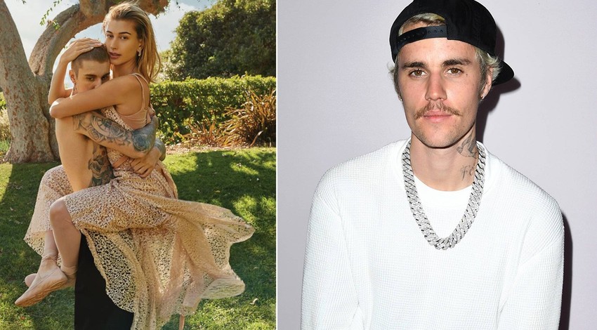 Hailey Bieber ile boşanacakları konuşuluyordu! Justin Bieber'ın son hali korkuttu! 10 yıl yaşlanmış gibi