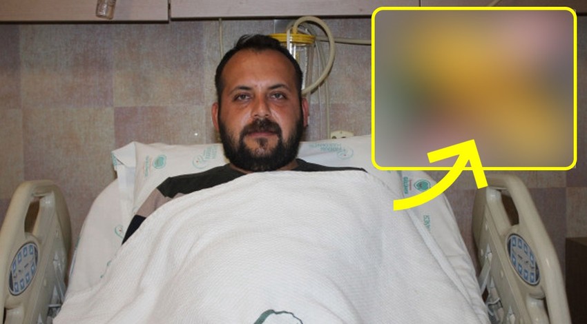 4 aydır yürüyemiyordu, ayağıdan çıkan şoke etti! "Nasıl fark edilmemiş?"