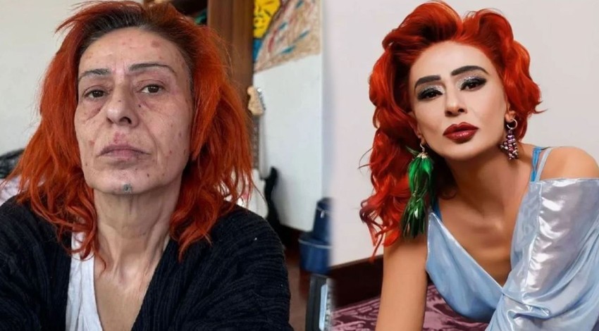 Yüzü yanan Yıldız Tilbe'den imaj değişikliği geldi! "Yaralarım geçmeyecekti"
