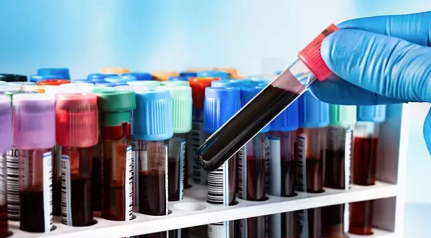 Bilim insanlarından çığır açan test! Artık o hastalık yıllar öncesinden tespit edilebilecek: Hem basit hem de uygun
