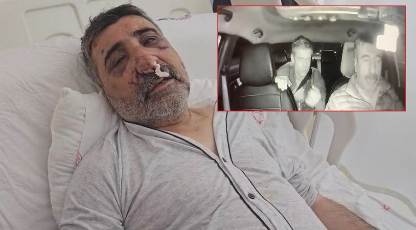 İngiliz boksörün darbettiği taksici konuştu! "Ben İngilizce bilmiyorum, o da Türkçe bilmiyor, ne olduğunu anlamadım"