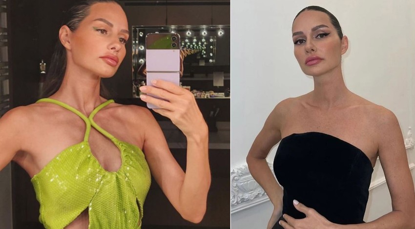 Yıllar içerisindeki değişimiyle gündemdeydi! Yasemin Özilhan'ın son yaptırdığı işlem ağızları açık bıraktı! Güzellik uğruna sınırları zorladı