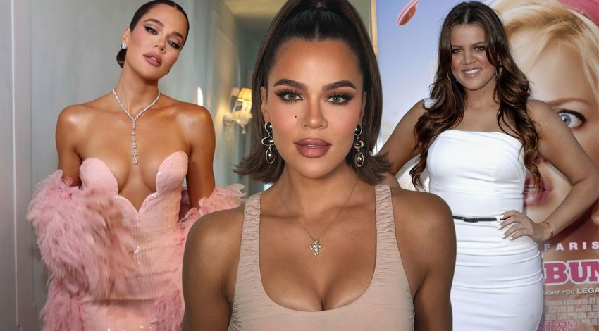 Khloe Kardashian'dan itiraf niteliğinde açıklama! Estetik işlemlerini teker teker saydı! Meğer güzelliğini onlara borçluymuş