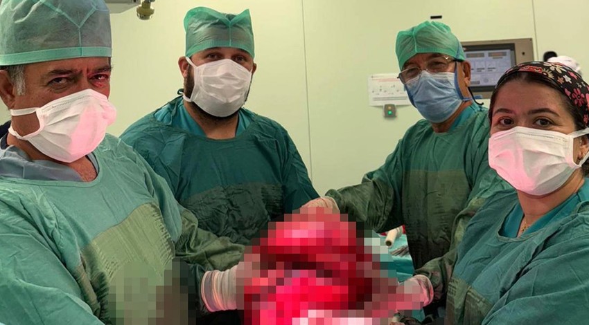 71 yaşındaki kadının karnından çıktı! Tam 9 kilo