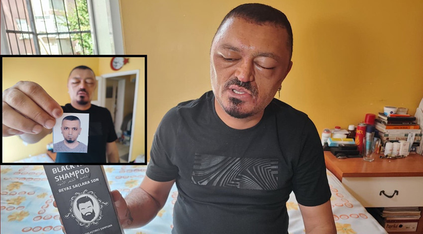 Berber tavsiyesi ile satın aldı: Artık tanınamaz halde!