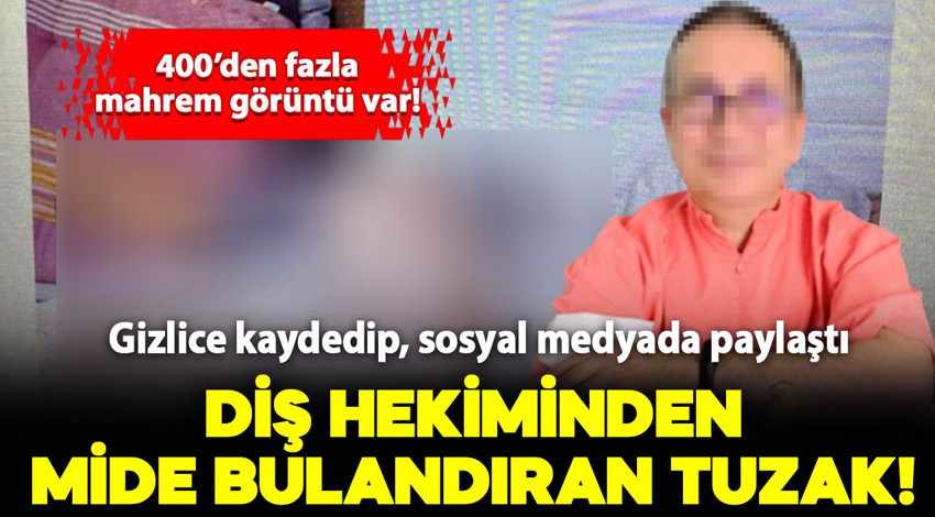 Diş hekiminden mide bulandıran gizli kamera tuzağı: 400'den fazla mahrem görüntü var!