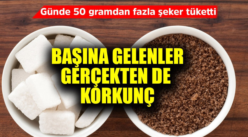 Günde 50 gramdan fazla şeker tüketti! Başına gelenler korkunç