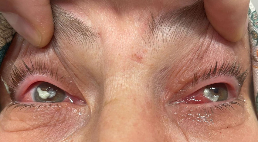 Kör eden ot!  "Gözlerine suyunu damlattı, göremez hale geldi" Uzmanlar uyardı: Önermiyoruz!