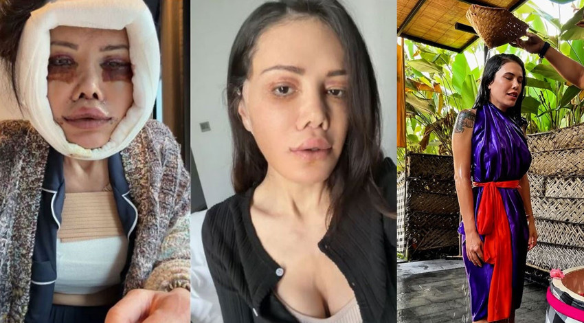 Yüz nakli sonrası hayatını kabusa dönmüştü! Didem Ceran Bali'de arınma ritüeline katıldı