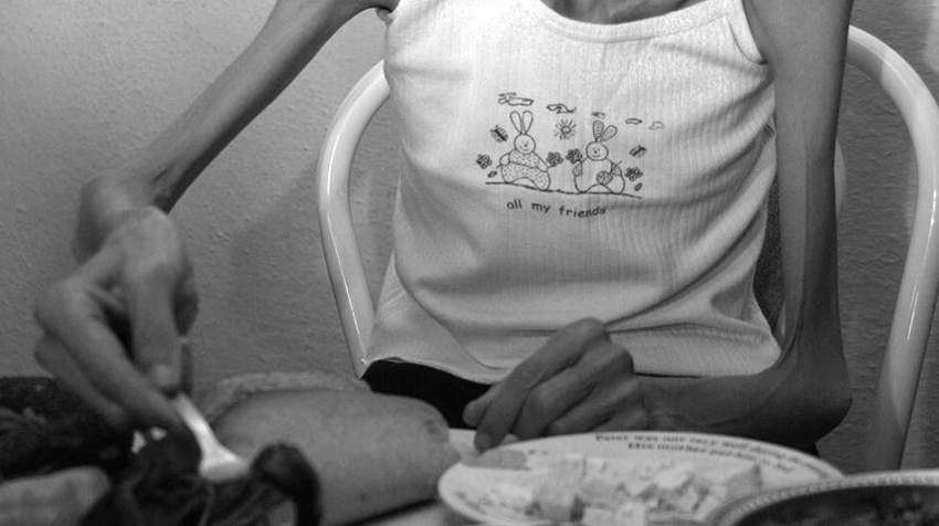 Nihal Candan'ın ölümüyle gözler bu ölümcül hastalığa çevrildi! Anoreksiya nedir, zorla yemek yedirmek mümkün mü? - Resim : 2