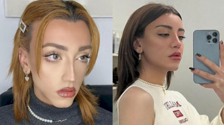 Cinsiyet değiştiren Mika Raun'dan korkutan haber! Kanama sebebiyle kadın doğum uzmanına gitti - Resim : 1