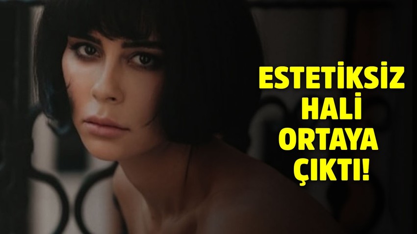 Masumiyet'in tescilli güzeli Banu'nun estetiksiz hali ortaya çıktı! Ünlü oyuncu meğer...