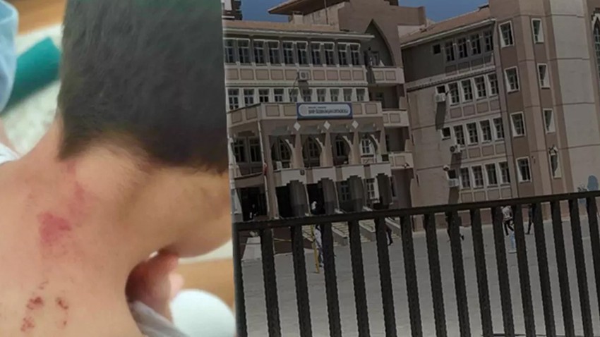 Görüntünün adresi Şanlıurfa! Tüm sınıfın önünde onu bu hale getirdi!
