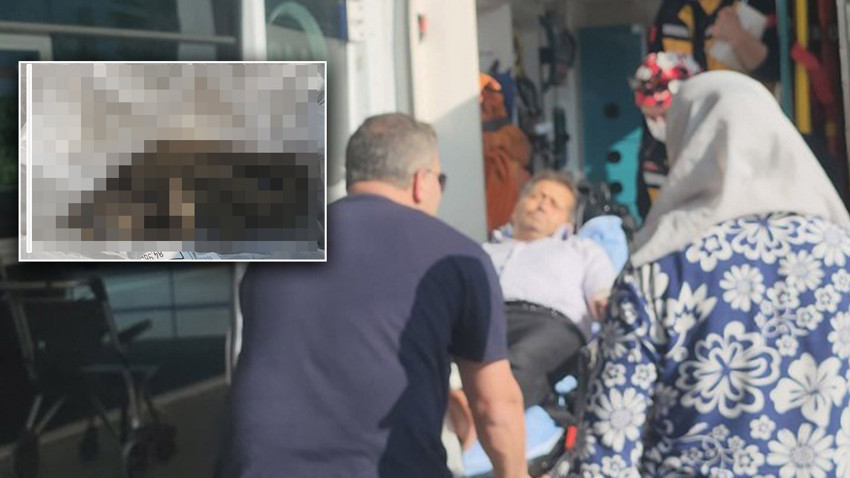 Ailesiyle pikniğe gitti, hayatının şokunu yaşadı! Hastaneye kaldırıldı