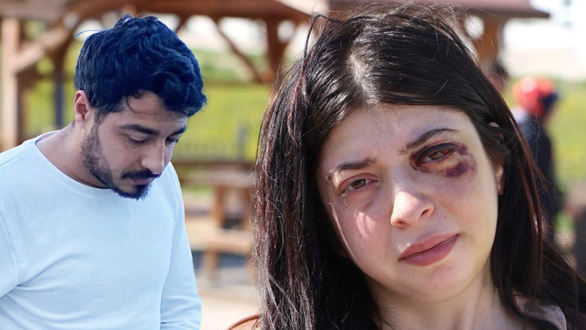 Sokak ortasında tacize uğrayıp darbedilmişti! Damla, saldırgan için çıkan kararı duyunca fenalaştı