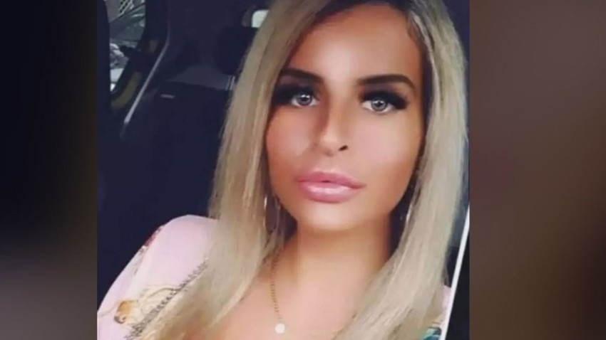 Sosyal medya fenomeninden çılgın hareket! Burnunu çıkartıp kavanozda saklamaya başladı