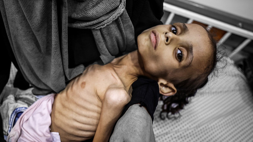 Gazze'de açlık yavaş yavaş öldürüyor!  9 yaşındaki Meryem 10 kiloya düştü! 'Bu benim kızım mı?'