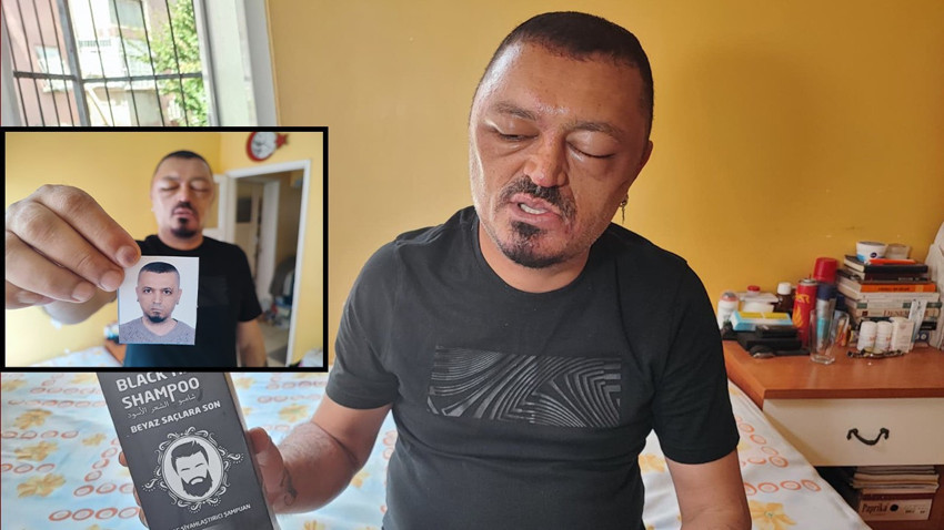 Berber tavsiyesi ile satın aldı: Artık tanınamaz halde!