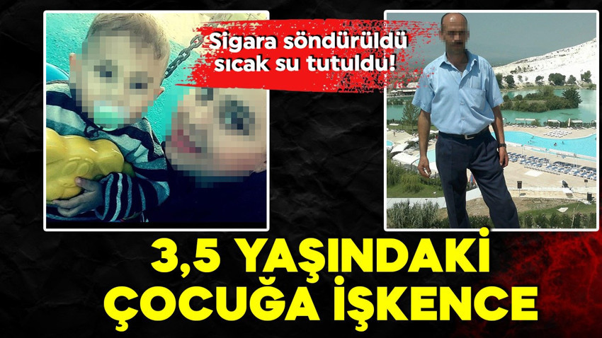 Konya'da 3,5 yaşındaki çocuğa şiddet! Sigara söndürüldü, sıcak su tutuldu!
