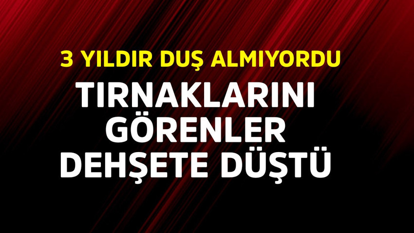 3 yıldır duş almıyordu! Tırnaklarını görenler dehşete düştü