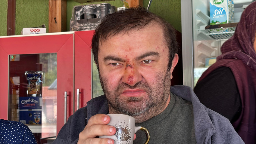 Bolu'da skandal olay! Yüzde 90 engelli vatandaş acımasızca darp edildi! - Resim : 2