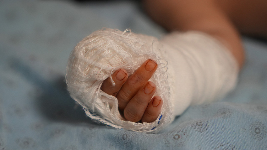 Hastanede skandal olay! Serum çıkarılırken 3 aylık bebeğin parmağı koptu - Resim : 3