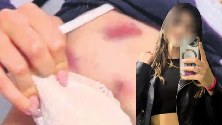 CHP’li meclis üyesine taciz ve darp suçlaması! Genç kadın yaşadığı dehşeti anlattı - Resim : 2