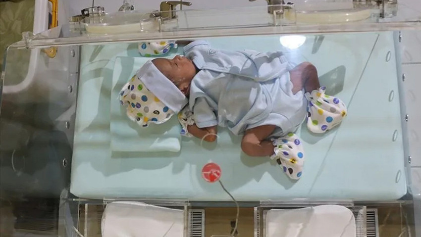 Anne karnına kadar ulaştı! Erken doğumda mikroplastik alarmı - Resim : 2