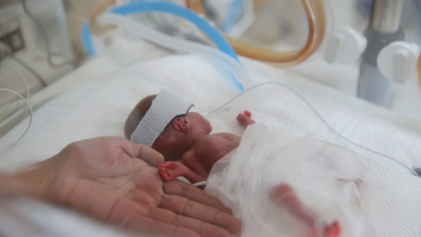 Anne karnına kadar ulaştı! Erken doğumda mikroplastik alarmı - Resim : 3