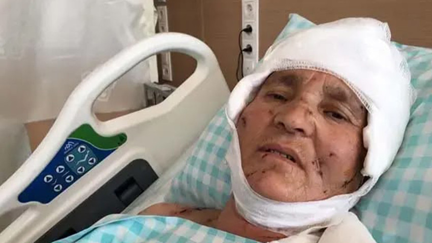 Yaşlı kadına hayatının kabusunu yaşatmıştı! Yargıtay'ın kararı emsal olacak: Saldırgan köpeğin sahiplerine dev ceza - Resim : 1
